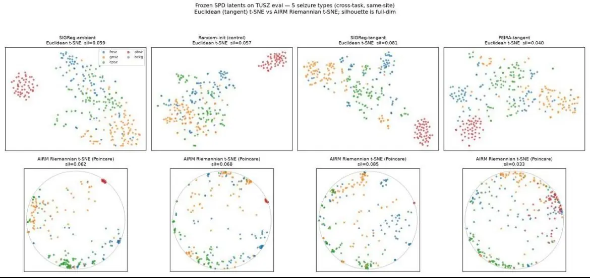 Frozen linear-probe balanced accuracy on held-out patients. Our in-domain result reaches 0.819 and our general-pretrained result 0.814, above every frozen foundation-model row quoted from EEG-FM-Bench — and above our own random-initialised encoder at 0.790, which is drawn on the same axis.